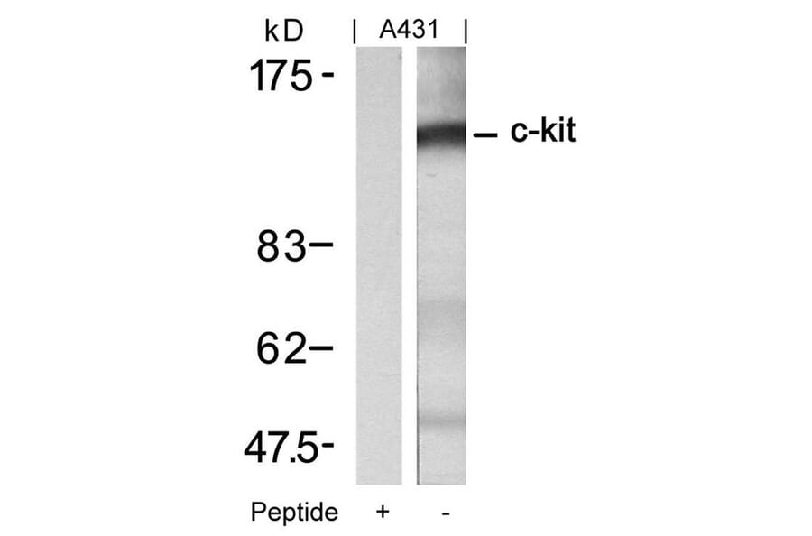 Western blot - c-Kit (Ab-721) Antibody from Signalway Antibody (21232) - Antibodies.com