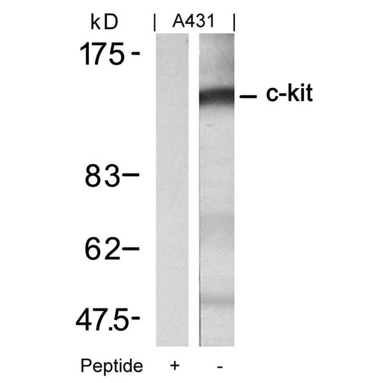 Western blot - c-Kit (Ab-721) Antibody from Signalway Antibody (21232) - Antibodies.com