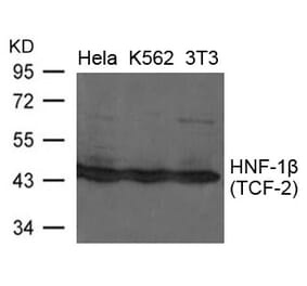 Western blot - HNF-1b (TCF-2) Antibody from Signalway Antibody (21658) - Antibodies.com