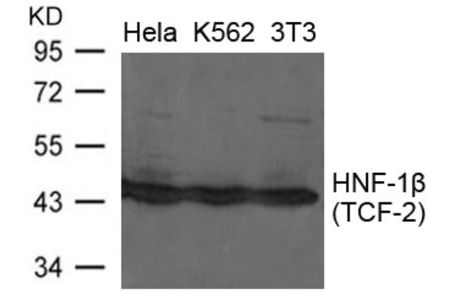 Western blot - HNF-1b (TCF-2) Antibody from Signalway Antibody (21658) - Antibodies.com