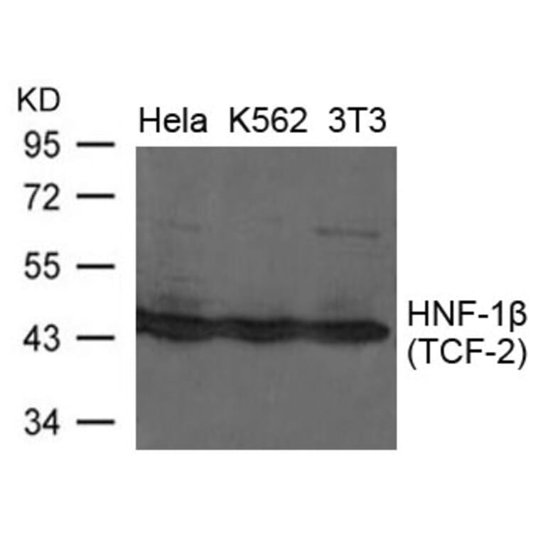 Western blot - HNF-1b (TCF-2) Antibody from Signalway Antibody (21658) - Antibodies.com