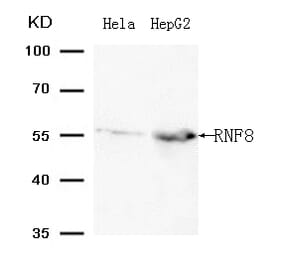 Western blot - RNF8 (Ab-198 ) Antibody from Signalway Antibody (21704) - Antibodies.com