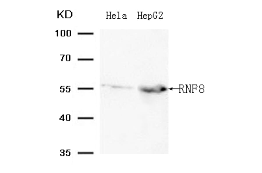Western blot - RNF8 (Ab-198 ) Antibody from Signalway Antibody (21704) - Antibodies.com
