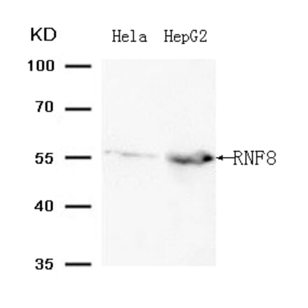 Western blot - RNF8 (Ab-198 ) Antibody from Signalway Antibody (21704) - Antibodies.com