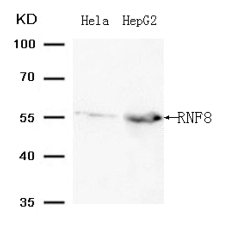 Western blot - RNF8 (Ab-198 ) Antibody from Signalway Antibody (21704) - Antibodies.com