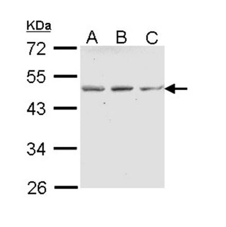 ENTPD5 (CD39L4) antibody from Signalway Antibody (22045) - Antibodies.com