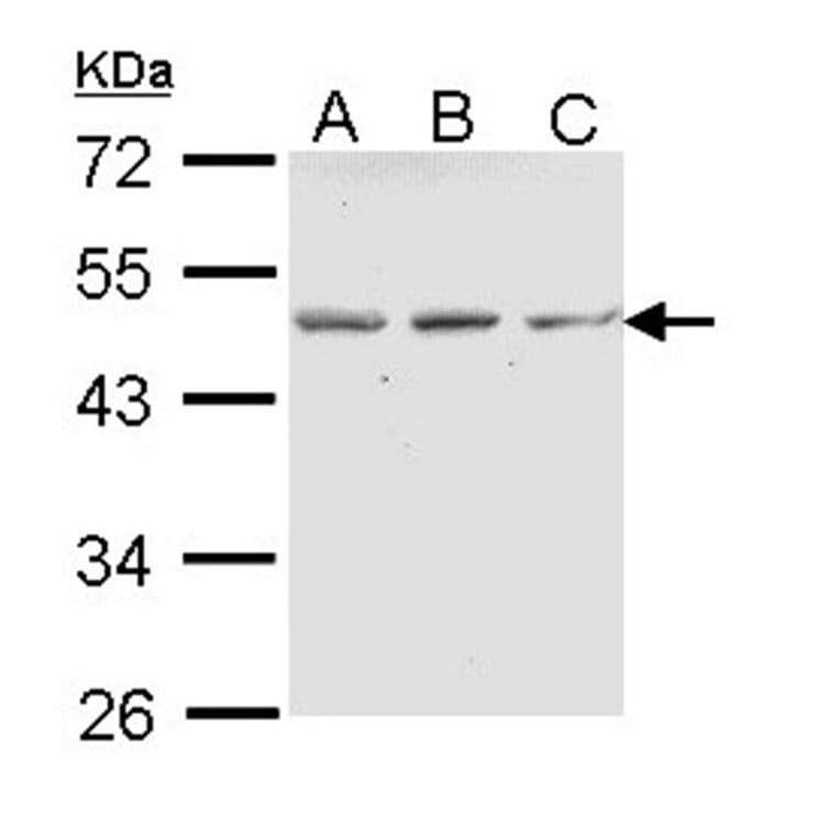 ENTPD5 (CD39L4) antibody from Signalway Antibody (22045) - Antibodies.com