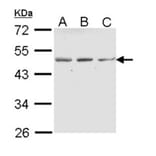 ENTPD5 (CD39L4) antibody from Signalway Antibody (22045) - Antibodies.com