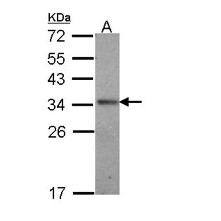 Interleukin-24 antibody from Signalway Antibody (22760) - Antibodies.com