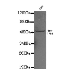 P53 Monoclonal Antibody from Signalway Antibody (27021) - Antibodies.com