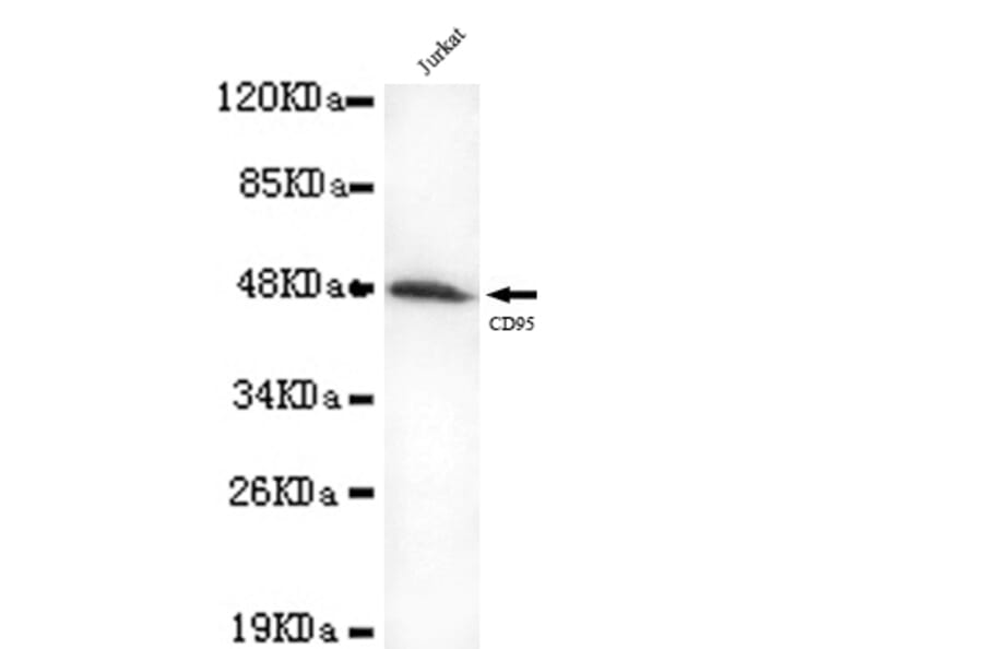 FAS Monoclonal Antibody from Signalway Antibody (27054) - Antibodies.com