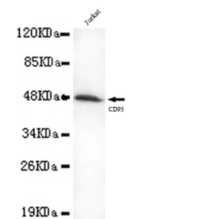 FAS Monoclonal Antibody from Signalway Antibody (27054) - Antibodies.com