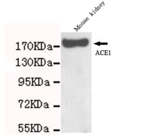 ACE Monoclonal Antibody from Signalway Antibody (27059) - Antibodies.com