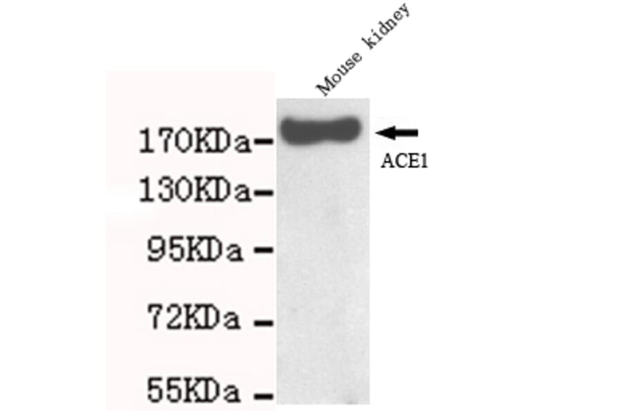 ACE Monoclonal Antibody from Signalway Antibody (27059) - Antibodies.com