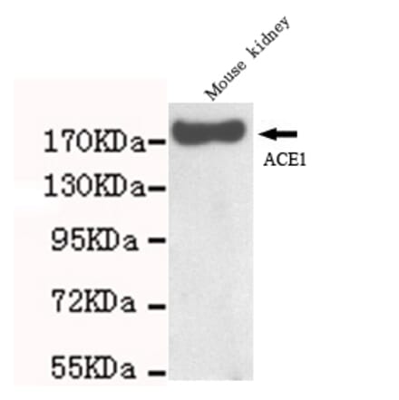 ACE Monoclonal Antibody from Signalway Antibody (27059) - Antibodies.com