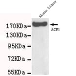 ACE Monoclonal Antibody from Signalway Antibody (27059) - Antibodies.com