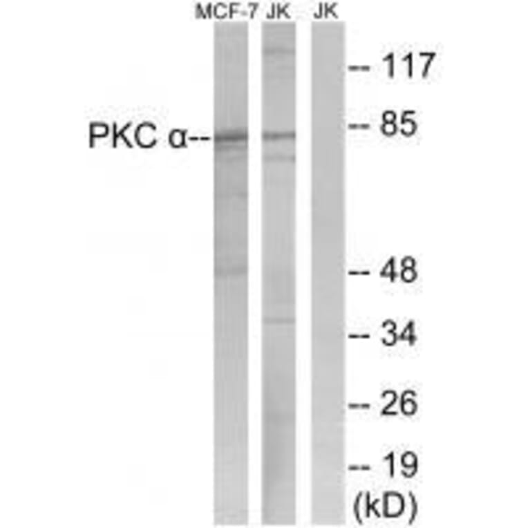 Western blot - PKC α (Ab-657) Antibody from Signalway Antibody (33150) - Antibodies.com