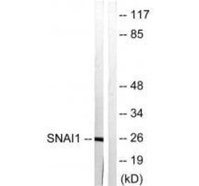 Western blot - SNAI1 (Ab-246) Antibody from Signalway Antibody (33182) - Antibodies.com