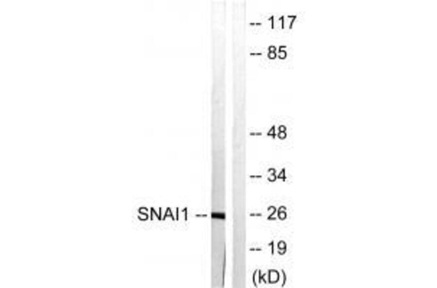 Western blot - SNAI1 (Ab-246) Antibody from Signalway Antibody (33182) - Antibodies.com