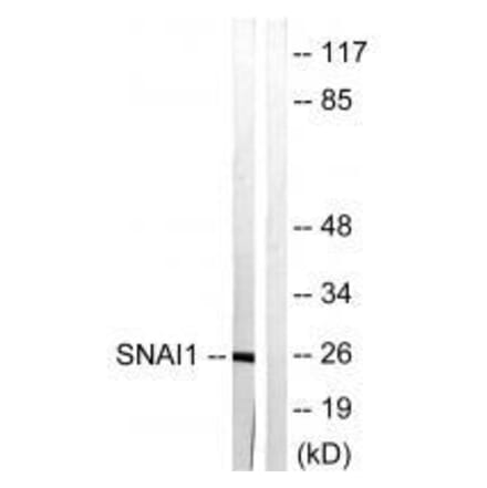 Western blot - SNAI1 (Ab-246) Antibody from Signalway Antibody (33182) - Antibodies.com