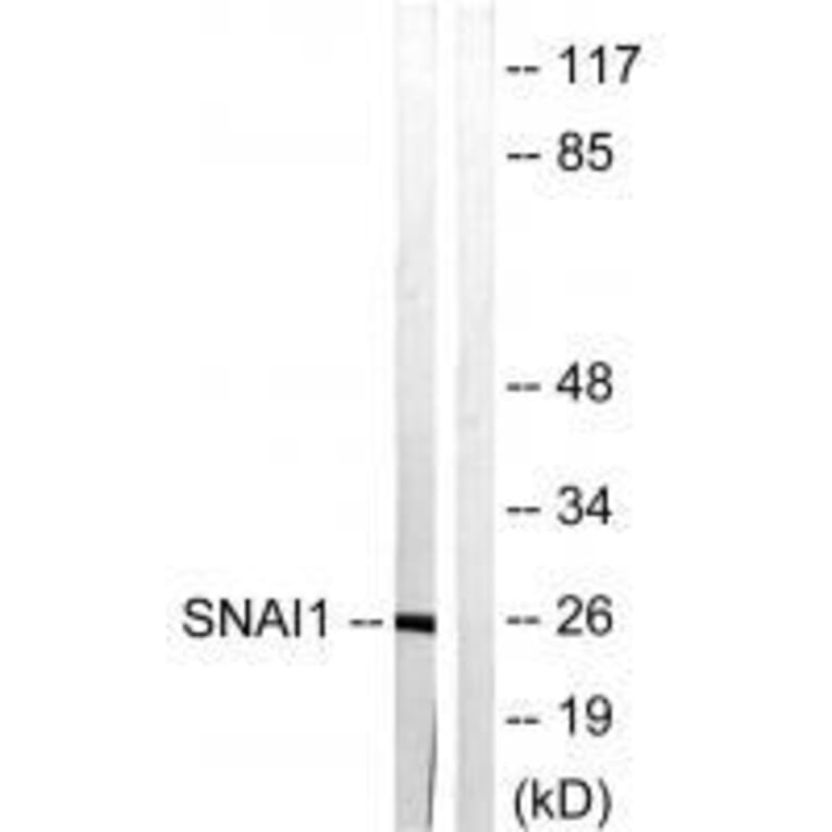 Western blot - SNAI1 (Ab-246) Antibody from Signalway Antibody (33182) - Antibodies.com