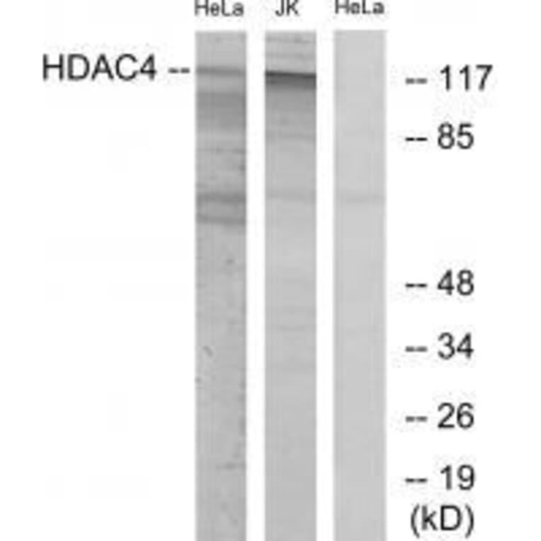 Western blot - HDAC4 (Ab-632) Antibody from Signalway Antibody (33190) - Antibodies.com