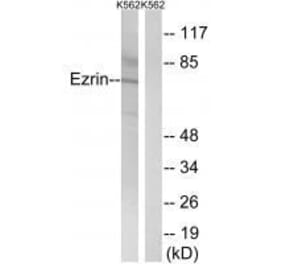 Western blot - Ezrin (Ab-478) Antibody from Signalway Antibody (33213) - Antibodies.com