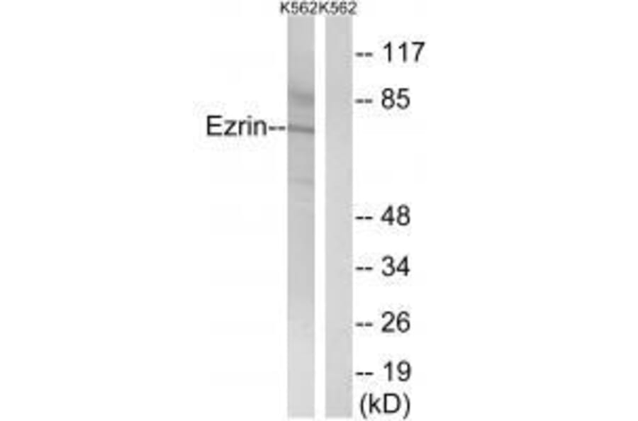 Western blot - Ezrin (Ab-478) Antibody from Signalway Antibody (33213) - Antibodies.com