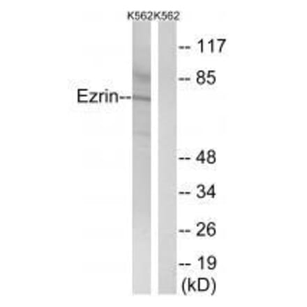 Western blot - Ezrin (Ab-478) Antibody from Signalway Antibody (33213) - Antibodies.com