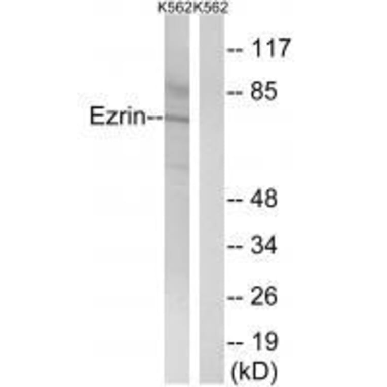 Western blot - Ezrin (Ab-478) Antibody from Signalway Antibody (33213) - Antibodies.com