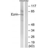 Western blot - Ezrin (Ab-478) Antibody from Signalway Antibody (33213) - Antibodies.com