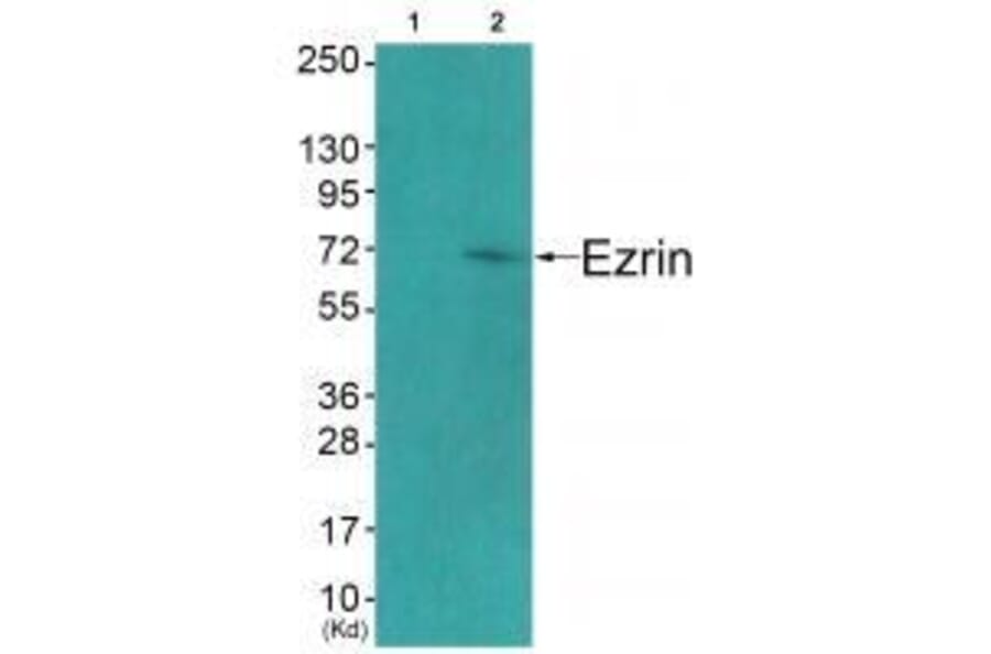 Western blot - Ezrin (Ab-478) Antibody from Signalway Antibody (33213) - Antibodies.com