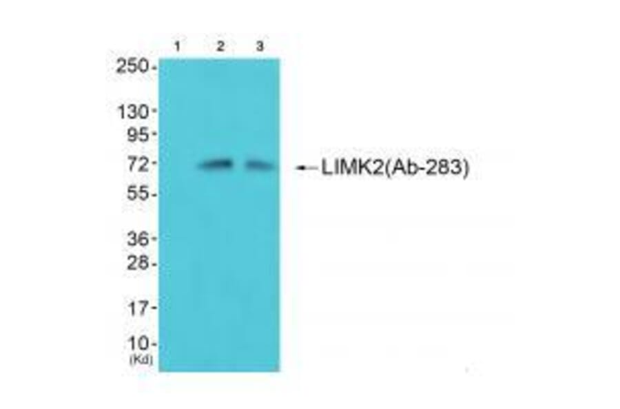 Western blot - LIMK2 (Ab-283) Antibody from Signalway Antibody (33218) - Antibodies.com