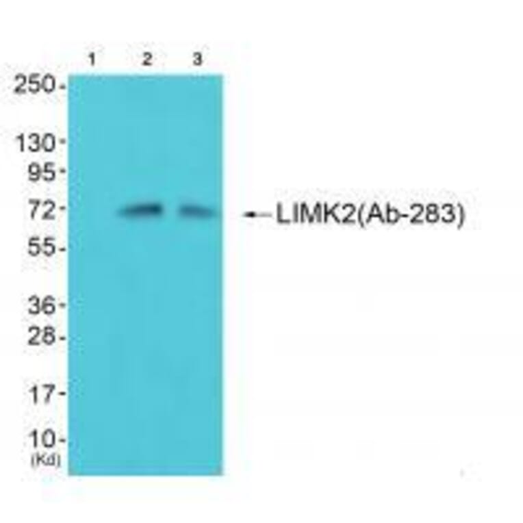 Western blot - LIMK2 (Ab-283) Antibody from Signalway Antibody (33218) - Antibodies.com