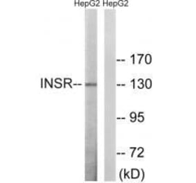 Western blot - INSR (Ab-1375) Antibody from Signalway Antibody (33230) - Antibodies.com