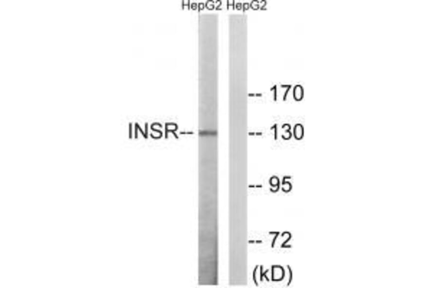 Western blot - INSR (Ab-1375) Antibody from Signalway Antibody (33230) - Antibodies.com