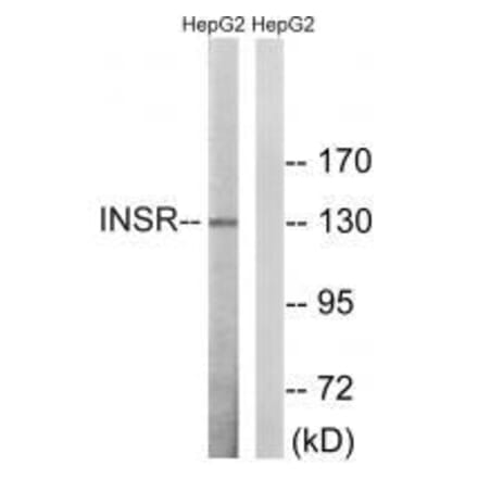 Western blot - INSR (Ab-1375) Antibody from Signalway Antibody (33230) - Antibodies.com