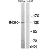 Western blot - INSR (Ab-1375) Antibody from Signalway Antibody (33230) - Antibodies.com
