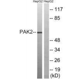 Western blot - PAK2 (Ab-192) Antibody from Signalway Antibody (33242) - Antibodies.com