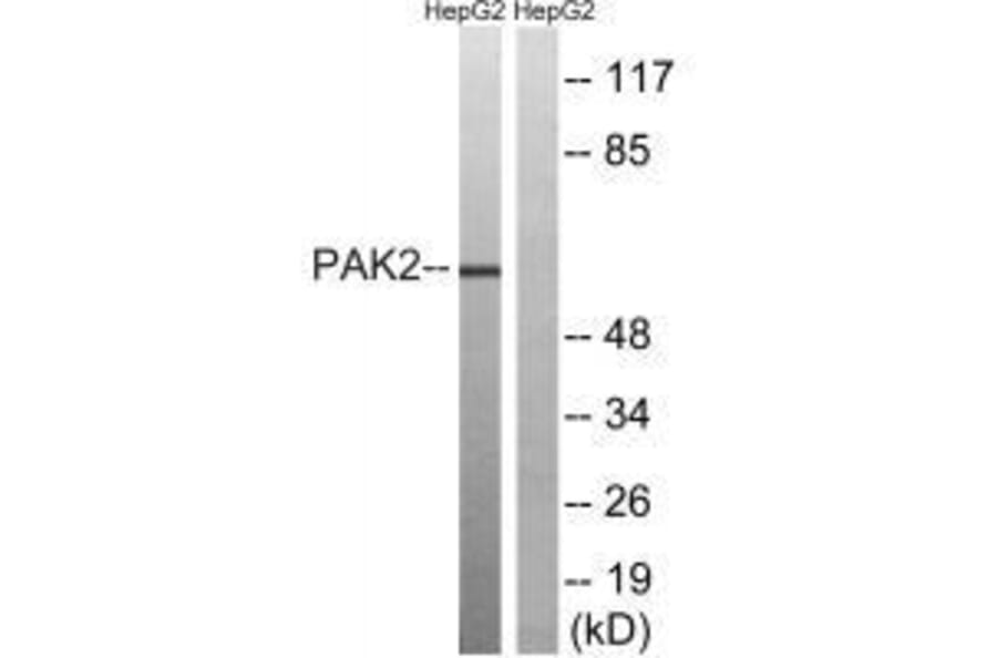 Western blot - PAK2 (Ab-192) Antibody from Signalway Antibody (33242) - Antibodies.com