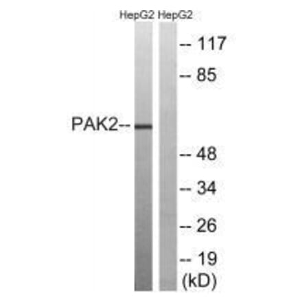 Western blot - PAK2 (Ab-192) Antibody from Signalway Antibody (33242) - Antibodies.com