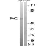 Western blot - PAK2 (Ab-192) Antibody from Signalway Antibody (33242) - Antibodies.com