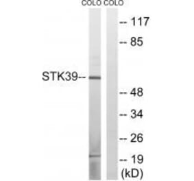 Western blot - STK39 (Ab-311) Antibody from Signalway Antibody (33251) - Antibodies.com