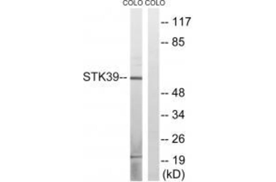 Western blot - STK39 (Ab-311) Antibody from Signalway Antibody (33251) - Antibodies.com