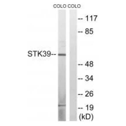 Western blot - STK39 (Ab-311) Antibody from Signalway Antibody (33251) - Antibodies.com