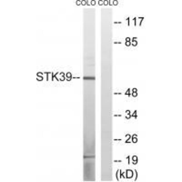 Western blot - STK39 (Ab-311) Antibody from Signalway Antibody (33251) - Antibodies.com