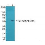 Western blot - STK39 (Ab-311) Antibody from Signalway Antibody (33251) - Antibodies.com