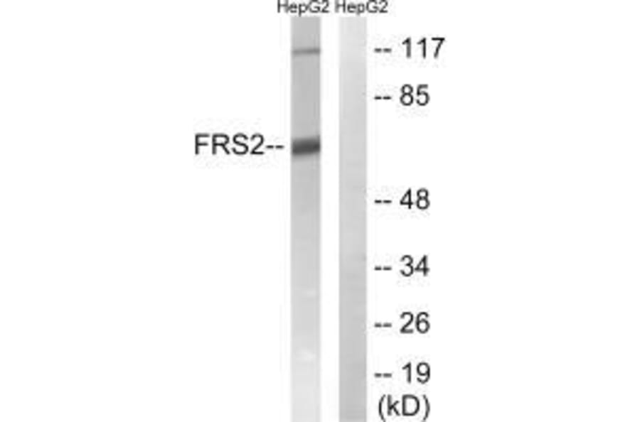 Western blot - FRS2 (Ab-196) Antibody from Signalway Antibody (33254) - Antibodies.com