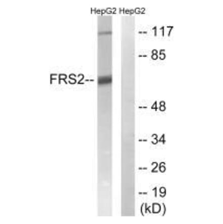 Western blot - FRS2 (Ab-196) Antibody from Signalway Antibody (33254) - Antibodies.com