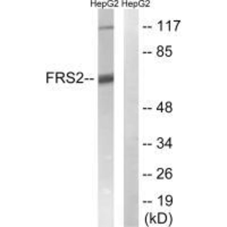 Western blot - FRS2 (Ab-196) Antibody from Signalway Antibody (33254) - Antibodies.com